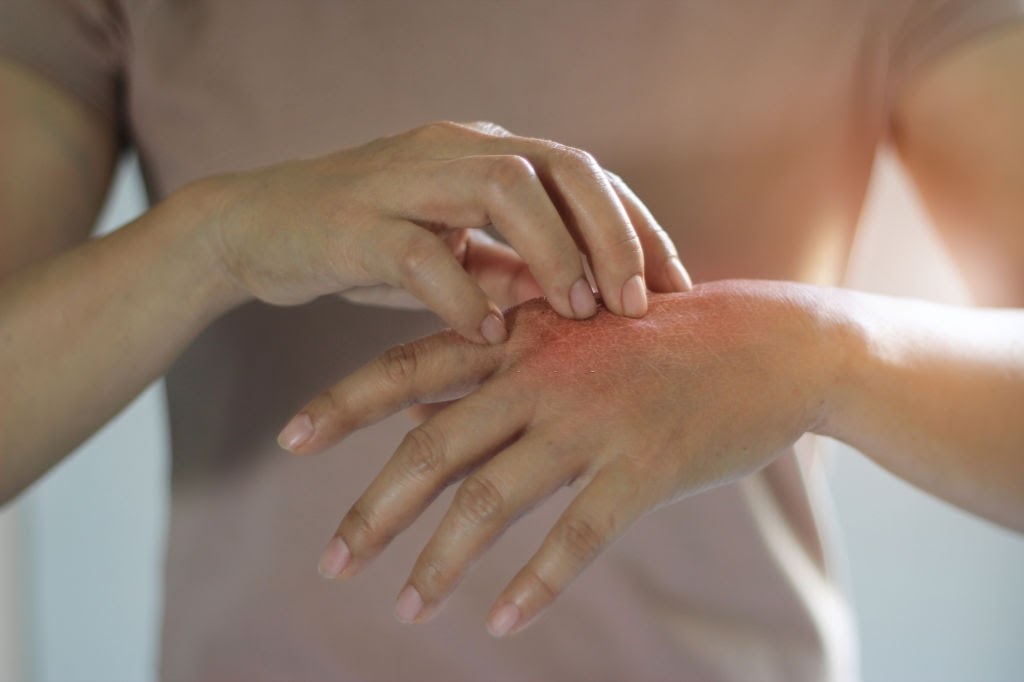 Afecta los microbiomas de nuestro cuerpo