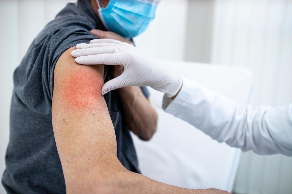 Dolor y enrojecimiento en el brazo inyectado